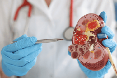 RIRS Surgery